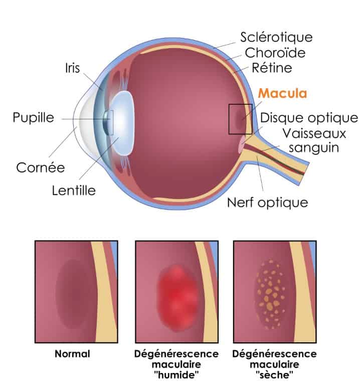 Schma de la dgnrescence maculaire
